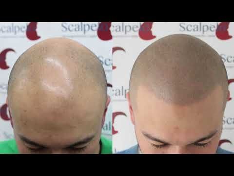 leals micropigmentacion capilar microblading barbershop